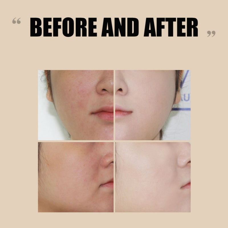 FAU Skin Solution BB Cream Results Before And After